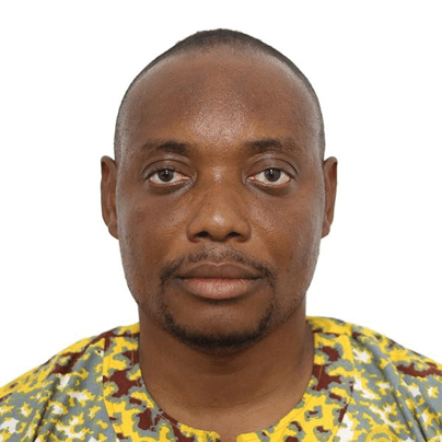 Glaucoma –the silent thief of sight