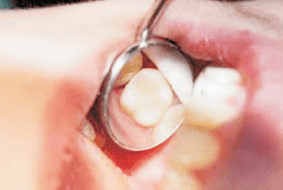 More than 6 out of 10 people have never visited a dentist