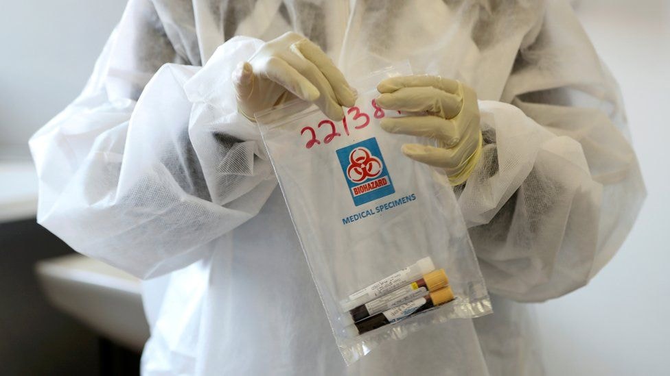 Ghana records new variant of COVID-19