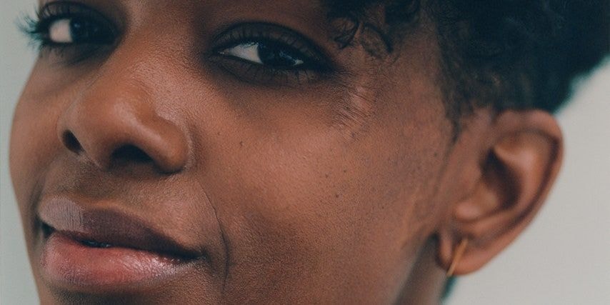 Sybil Shaibu column: Do you have scars?