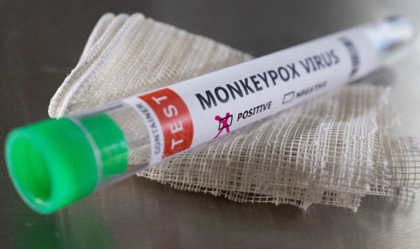 Monkeypox On the Rise in Africa, United States and Europe - says WHO