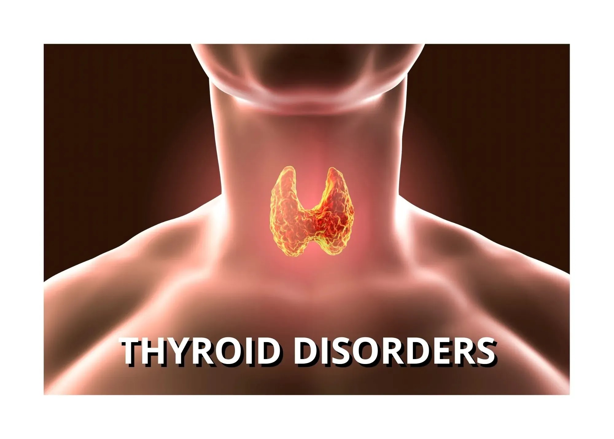 Thyroid Disease