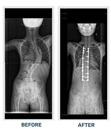 TheHealthReport25: World Health Day 2025 – prioritising spine health for a stronger future